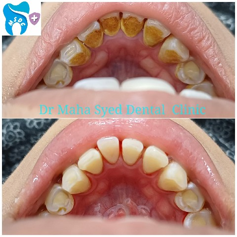 Dental Treatment Gallery 10