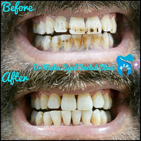 Dental Treatment Gallery 2