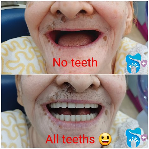 Dental Treatment Gallery 4