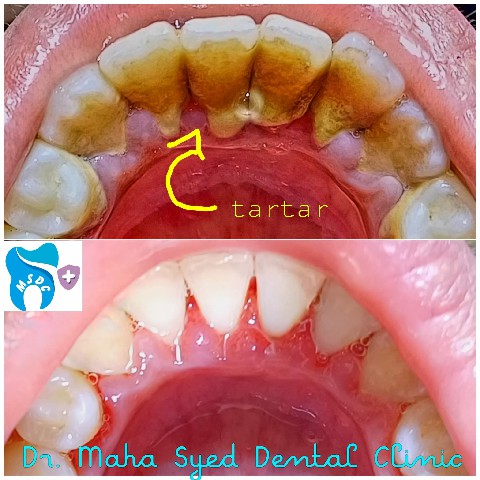Dental Treatment Gallery 5