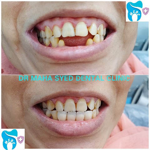 Dental Treatment Gallery 9