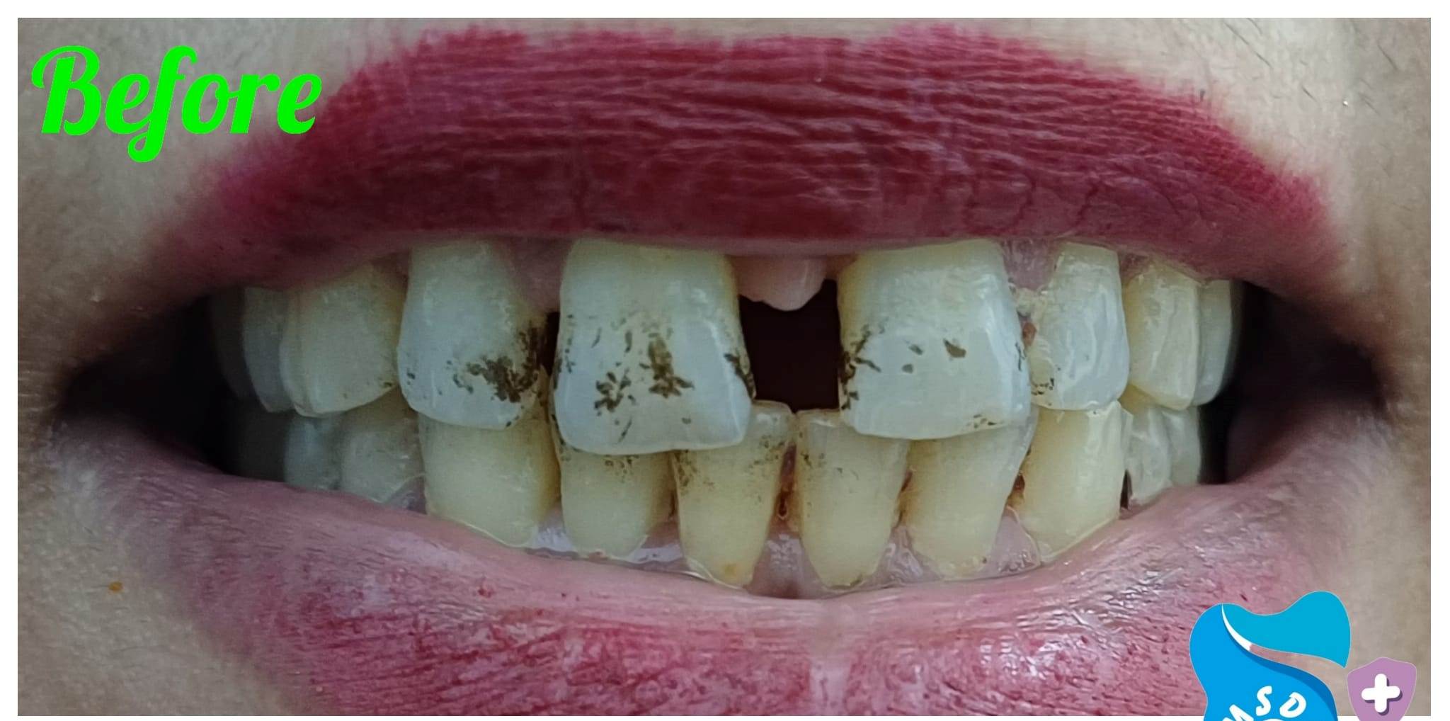 Dr Maha Syed Dental Clinic Treatment 1